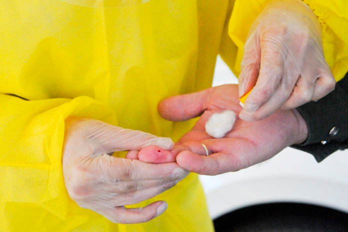 Recorde de casos foi na última sexta-feira (29), com 501 testes positivos Foto- Geovana Albuquerque _ Secretaria de Saúde
