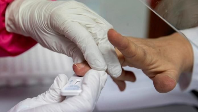 GDF disponibiliza mais de 300 mil kits de testes rápidos para a população; testagem inicia no dia 6 de julho
