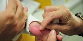 Rede pública de saúde oferece diagnóstico de doença falciforme por meio de teste do pezinho