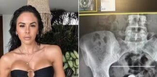 Quem é a atriz que “engoliu” um plug an4l pelo furico?