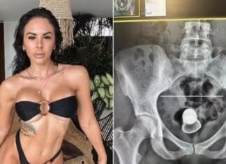 Quem é a atriz que “engoliu” um plug an4l pelo furico?