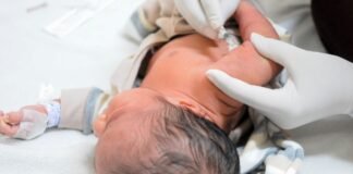 Vacina aplicada em recém-nascidos é essencial na prevenção de tuberculose