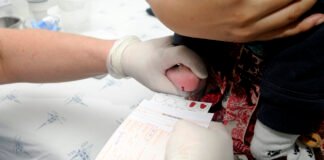 Divulgado primeiro boletim com dados sobre anomalias congênitas no Distrito Federal