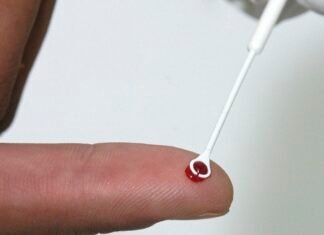 Fiji declara emergência nacional por HIV com 1 caso a cada 60 pessoas